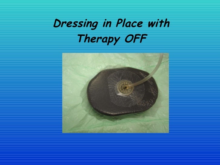 Healing The Wound The Vac System In Woundcare