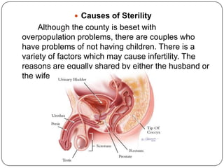  Causes of Sterility
Although the county is beset with
overpopulation problems, there are couples who
have problems of not having children. There is a
variety of factors which may cause infertility. The
reasons are equally shared by either the husband or
the wife.
 