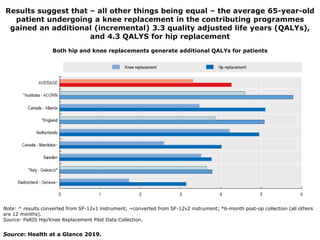 Results suggest that – all other things being equal – the average 65-year-old
patient undergoing a knee replacement in the contributing programmes
gained an additional (incremental) 3.3 quality adjusted life years (QALYs),
and 4.3 QALYS for hip replacement
Source: Health at a Glance 2019.
Note: ^ results converted from SF-12v1 instrument; ~converted from SF-12v2 instrument; *6-month post-op collection (all others
are 12 months).
Source: PaRIS Hip/Knee Replacement Pilot Data Collection.
Both hip and knee replacements generate additional QALYs for patients
 