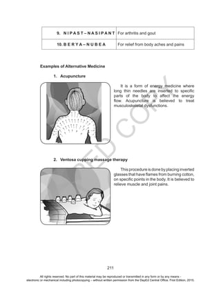 D
EPED
C
O
PY
211
9.	 N I P A S T – N A S I P A N T For arthritis and gout
10.	B E R Y A – N U B E A For relief from body aches and pains
Examples of Alternative Medicine
1.	 Acupuncture
	 It is a form of energy medicine where
long thin needles are inserted to specific
parts of the body to affect the energy
flow. Acupuncture is believed to treat
musculoskeletal dysfunctions.
2.	 Ventosa cupping massage therapy
	
	 Thisprocedureisdonebyplacinginverted
glasses that have flames from burning cotton,
on specific points in the body. It is believed to
relieve muscle and joint pains.
All rights reserved. No part of this material may be reproduced or transmitted in any form or by any means -
electronic or mechanical including photocopying – without written permission from the DepEd Central Office. First Edition, 2015.
 