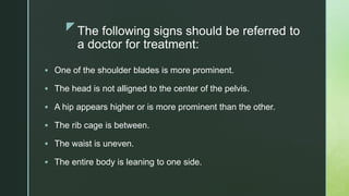 zThe following signs should be referred to
a doctor for treatment:
 One of the shoulder blades is more prominent.
 The head is not alligned to the center of the pelvis.
 A hip appears higher or is more prominent than the other.
 The rib cage is between.
 The waist is uneven.
 The entire body is leaning to one side.
 