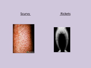 Health and diseases | PPTX