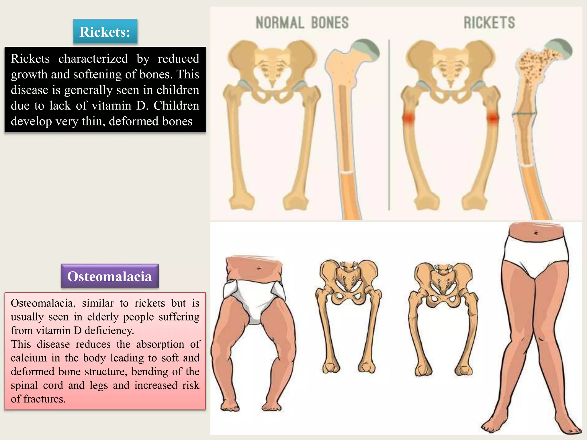 NUTRITION & HEALTH | PPTX