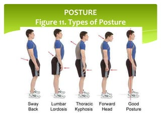 POSTURE
Figure 11. Types of Posture
 