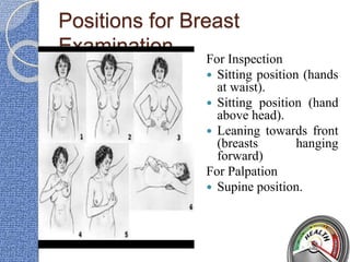 Positions for Breast
Examination
For Inspection
 Sitting position (hands
at waist).
 Sitting position (hand
above head).
 Leaning towards front
(breasts hanging
forward)
For Palpation
 Supine position.
 