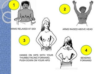BENDING
FORWARD
ARMS RELAXED AT SIDE
HANDS ON HIPS WITH YOUR
THUMBS FACING FORWARD,
PUSH DOWN ON YOUR HIPS
ARMS RAISED ABOVE HEAD
2
3
1
4
 
