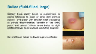 Health Assessment Findings on Skin Assessment.pptx
