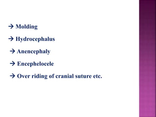  Molding
 Hydrocephalus
 Anencephaly
 Encephelocele
 Over riding of cranial suture etc.
 