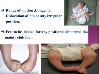  Feet to be looked for any positional abnormalities
mainly club foot.
 Range of motion ,Congenial
Dislocation of hip or any irregular
position.
 