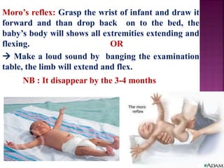 Moro’s reflex: Grasp the wrist of infant and draw it
forward and than drop back on to the bed, the
baby’s body will shows all extremities extending and
flexing. OR
 Make a loud sound by banging the examination
table, the limb will extend and flex.
NB : It disappear by the 3-4 months
 