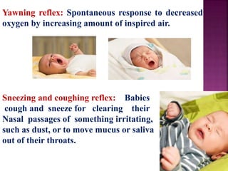 Yawning reflex: Spontaneous response to decreased
oxygen by increasing amount of inspired air.
Sneezing and coughing reflex: Babies
cough and sneeze for clearing their
Nasal passages of something irritating,
such as dust, or to move mucus or saliva
out of their throats.
 