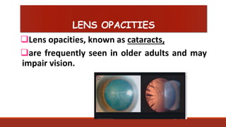 Health assessment on examination of the eyes | PPTX