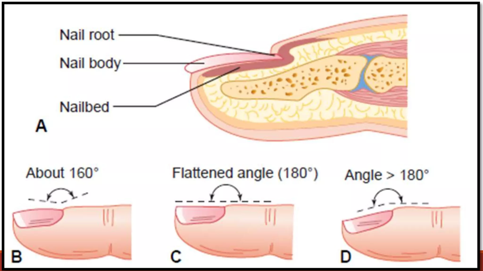 Nail Pattern Inspection Layout Health assessment on the nail examination | PPTX
