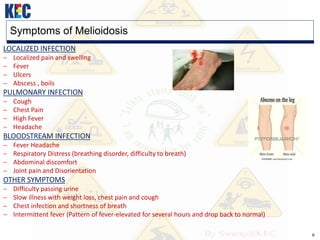 6
Symptoms of Melioidosis
LOCALIZED INFECTION
 Localized pain and swelling
 Fever
 Ulcers
 Abscess , boils
PULMONARY INFECTION
 Cough
 Chest Pain
 High Fever
 Headache
BLOODSTREAM INFECTION
 Fever Headache
 Respiratory Distress (breathing disorder, difficulty to breath)
 Abdominal discomfort
 Joint pain and Disorientation
OTHER SYMPTOMS
 Difficulty passing urine
 Slow illness with weight loss, chest pain and cough
 Chest infection and shortness of breath
 Intermittent fever (Pattern of fever-elevated for several hours and drop back to normal)
 