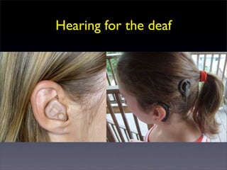 Hearing for the deaf
 