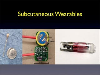 Subcutaneous Wearables
 