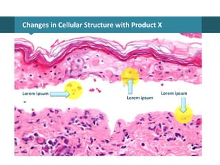 Changes in Cellular Structure with Product X
Lorem ipsum
Lorem ipsum Lorem ipsum
 