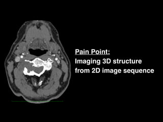 Pain Point:
Imaging 3D structure
from 2D image sequence
 