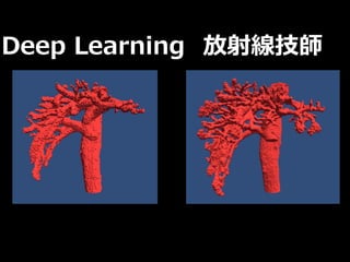 Deep Learning 放射線技師
 
