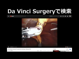 Da Vinci Surgeryで検索
 