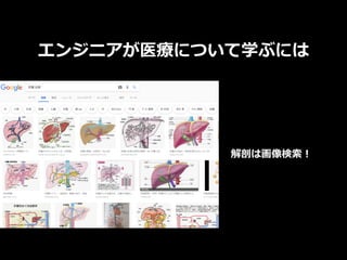 エンジニアが医療について学ぶには
解剖は画像検索！
 