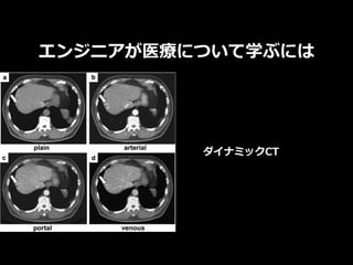エンジニアが医療について学ぶには
ダイナミックCT
 
