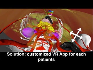 B
Solution: customized VR App for each
patients
 