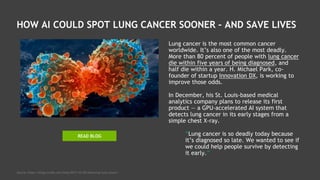 HOW AI COULD SPOT LUNG CANCER SOONER – AND SAVE LIVES
Lung cancer is the most common cancer
worldwide. It’s also one of the most deadly.
More than 80 percent of people with lung cancer
die within five years of being diagnosed, and
half die within a year. H. Michael Park, co-
founder of startup Innovation DX, is working to
improve those odds.
In December, his St. Louis-based medical
analytics company plans to release its first
product — a GPU-accelerated AI system that
detects lung cancer in its early stages from a
simple chest X-ray.
“Lung cancer is so deadly today because
it’s diagnosed so late. We wanted to see if
we could help people survive by detecting
it early.”
Source: https://blogs.nvidia.com/blog/2017/10/30/detecting-lung-cancer/
READ BLOG
 