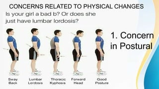CONCERNS RELATED TO PHYSICAL CHANGES
1. Concern
in Postural
 