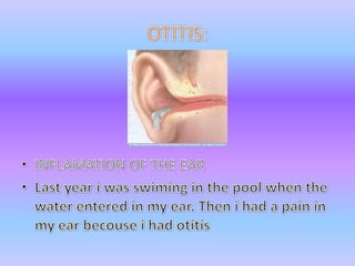 OTITIS:INFLAMATION OF THE EARLastyear i wasswiming in the pool whenthewaterentered in my ear. Then i had a pain in my earbecouse i had otitis
