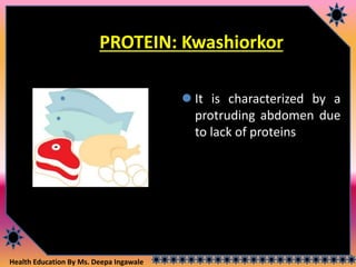 Health Education By Ms. Deepa Ingawale
PROTEIN: Kwashiorkor
 It is characterized by a
protruding abdomen due
to lack of proteins
 
