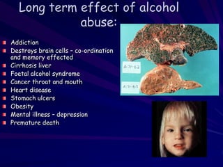 Long term effect of alcohol
abuse:
Addiction
Destroys brain cells – co-ordination
and memory effected
Cirrhosis liver
Foetal alcohol syndrome
Cancer throat and mouth
Heart disease
Stomach ulcers
Obesity
Mental illness – depression
Premature death
 
