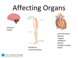 Affecting Organs Ischemic Stroke Peripheral Vascular Disease Coronary Heart Disease Angina MI(Heart Attack)‏ Sudden Cardiac Death 