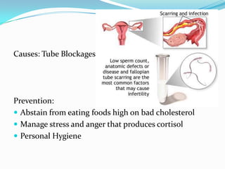 Causes: Tube Blockages




Prevention:
 Abstain from eating foods high on bad cholesterol
 Manage stress and anger that produces cortisol
 Personal Hygiene
 