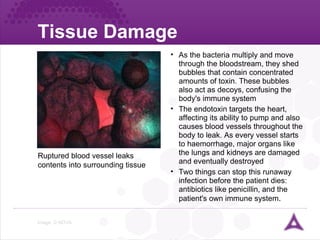 Tissue Damage Image: © NOVA Ruptured blood vessel leaks contents into surrounding tissue   As the bacteria multiply and move through the bloodstream, they shed bubbles that contain concentrated amounts of toxin. These bubbles also act as decoys, confusing the body's immune system The endotoxin targets the heart, affecting its ability to pump and also causes blood vessels throughout the body to leak. As every vessel starts to haemorrhage, major organs like the lungs and kidneys are damaged and eventually destroyed Two things can stop this runaway infection before the patient dies: antibiotics like penicillin, and the patient's own immune system .  