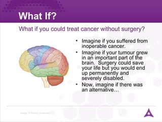 What If? Image: © Dorling Kindersley What if you could treat cancer without surgery? Imagine if you suffered from inoperable cancer. Imagine if your tumour grew in an important part of the brain.  Surgery could save your life but you would end up permanently and severely disabled. Now, imagine if there was an alternative… 