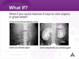 What If? What if you could improve X-rays to view organs in great detail? Image: © Nanoprobes X-ray of live mouse kidneys using: Iodine as contrast agent Gold nanoparticles as contrast agent kidney ureter spine 