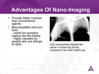 Advantages Of Nano-Imaging Image: © Nanoprobes ureter Provide better contrast than conventional agents Biocompatible and non-toxic - useful for sensitive organs like the kidney - highly valuable for people who are allergic to dyes. Gold nanoparticles highlight the cancer in mouse leg (arrow) compared to the other healthy leg. 