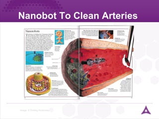 Nanobot To Clean Arteries Image: © Dorling Kindersley ureter 
