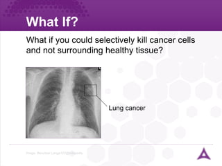 What If? Image: Benutzer:Lange123@wikipedia What if you could selectively kill cancer cells and not surrounding healthy tissue? Lung cancer 