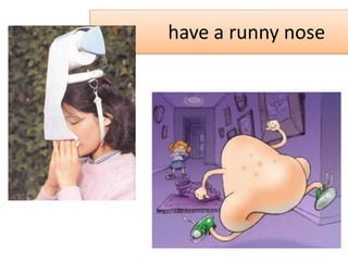 have a runny nose