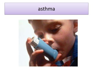 asthma