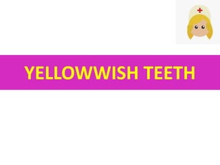 YELLOWWISH TEETH
 