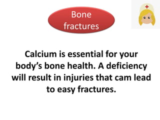Calcium is essential for your
body’s bone health. A deficiency
will result in injuries that cam lead
to easy fractures.
Bone
fractures
 