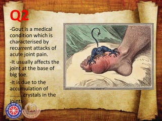 Q2
-Gout is a medical
condition which is
characterised by
recurrent attacks of
acute joint pain.
-It usually affects the
joint at the base of
big toe.
-It is due to the
accumulation of
……… crystals in the
joints.
 