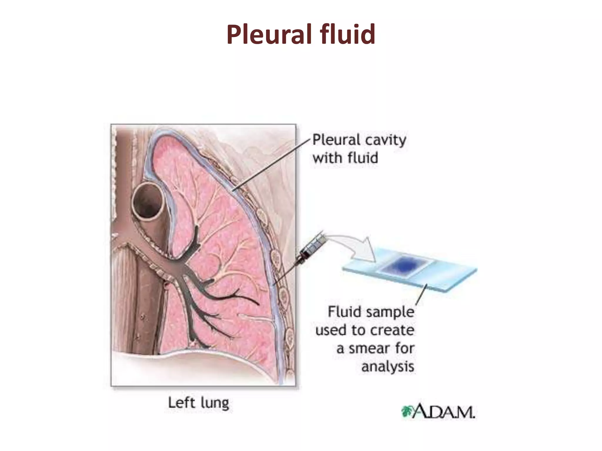 Pleural fluid 
 