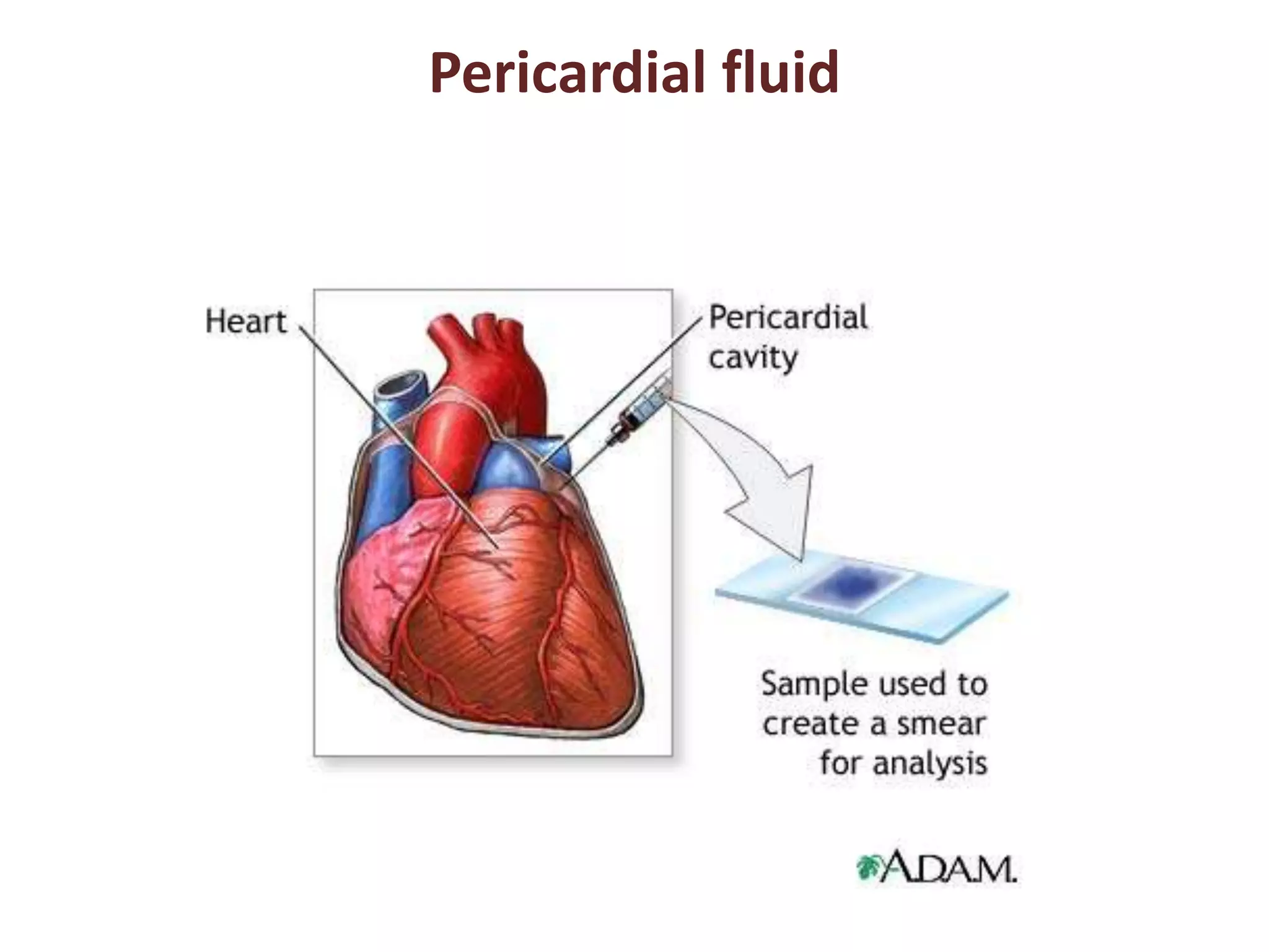 Pericardial fluid 
 