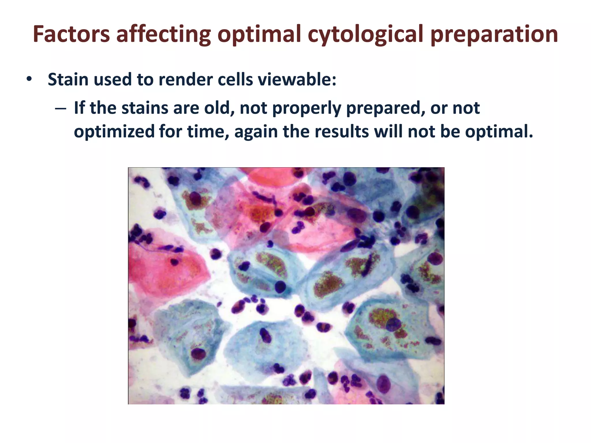 Factors affecting optimal cytological preparation 
• Stain used to render cells viewable: 
– If the stains are old, not properly prepared, or not 
optimized for time, again the results will not be optimal. 
 