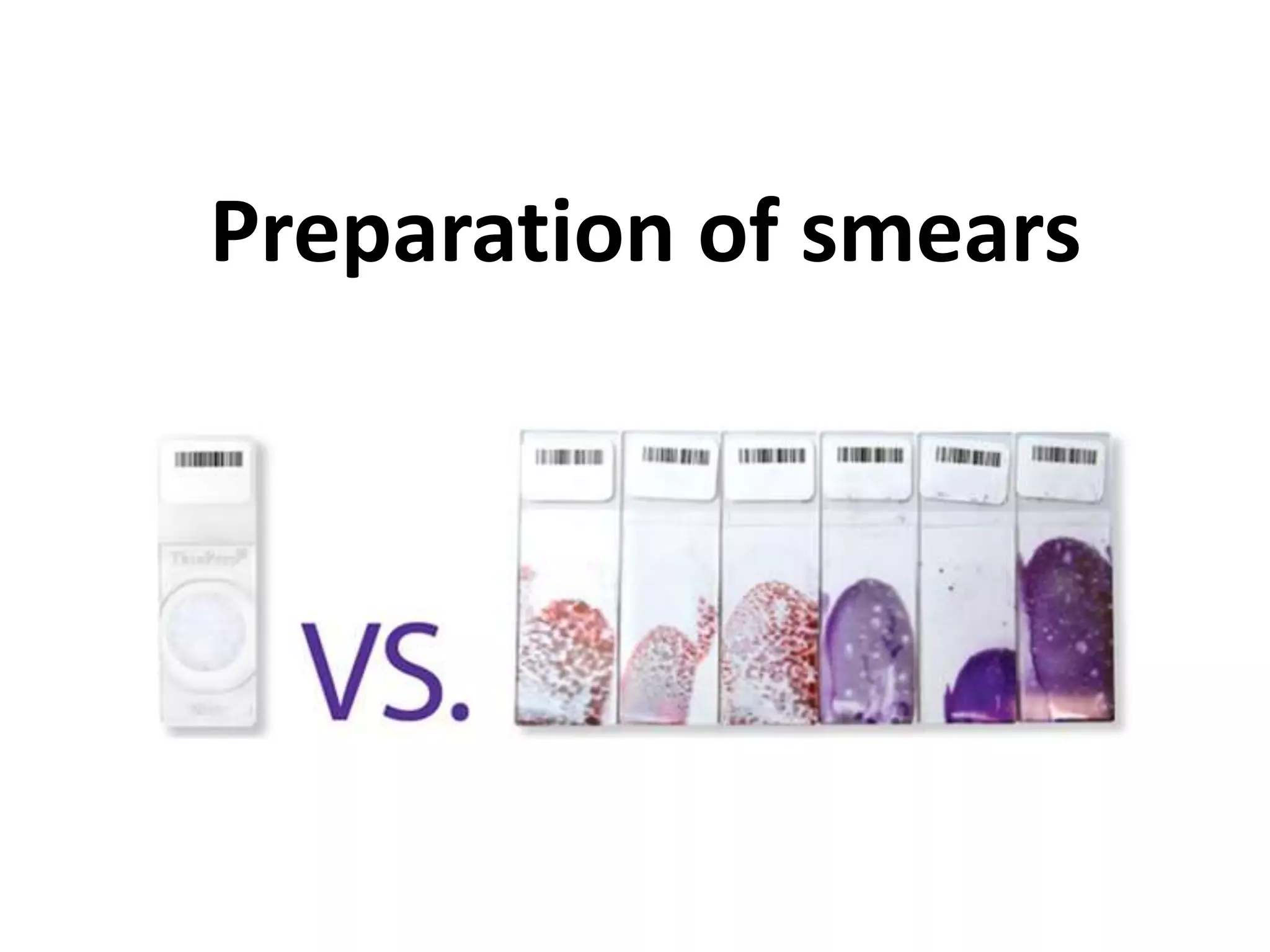 Preparation of smears 
 