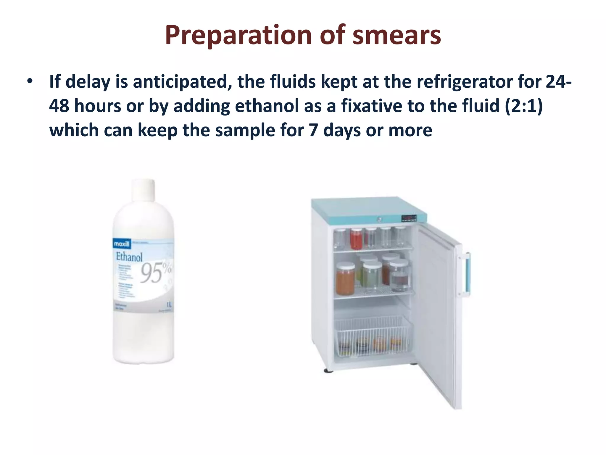 Preparation of smears 
• If delay is anticipated, the fluids kept at the refrigerator for 24- 
48 hours or by adding ethanol as a fixative to the fluid (2:1) 
which can keep the sample for 7 days or more 
 